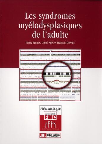 Couverture du livre « Les syndrômes myélodysplasiques de l'adulte » de P Fenaux aux éditions John Libbey