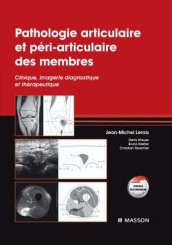 Couverture du livre « Pathologie articulaire des membres » de J-M Lerais aux éditions Elsevier-masson