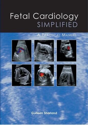 Couverture du livre « Fetal Cardiology Simplified » de Gurleen Sharland aux éditions Tfm Publishing Ltd