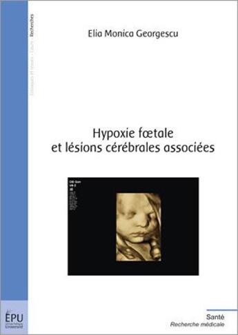 Couverture du livre « Hypoxie foetale et lésions cérébrales associées » de Elia Monica Georgescu aux éditions Publibook