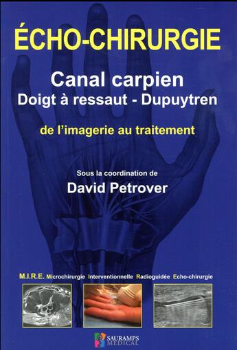 Couverture du livre « Écho-chirurgie ; canal carpien, doigt à ressaut, Dupuytren » de Petrover David aux éditions Sauramps Medical