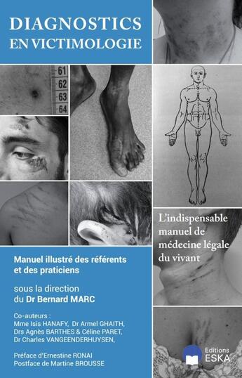 Couverture du livre « DIAGNOTICS EN VICTIMOLOGIE : MANUEL ILLUSTRE DES REFERENTS ET DES PRATICIENS » de Bernard Marc & All aux éditions Eska