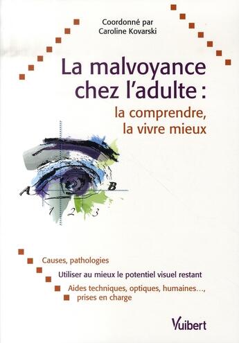 Couverture du livre « La malvoyance chez l'adulte ; la comprendre, la vivre mieux » de Caroline Kovarski aux éditions Vuibert