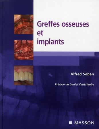 Couverture du livre « Greffes osseuses et implants » de Seban-A aux éditions Elsevier-masson