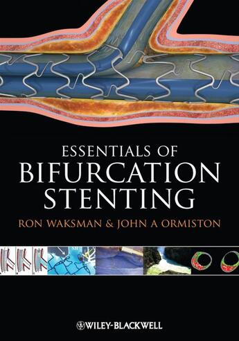 Couverture du livre « Bifurcation Stenting » de Ron Waksman et John A. Ormiston aux éditions Wiley-blackwell