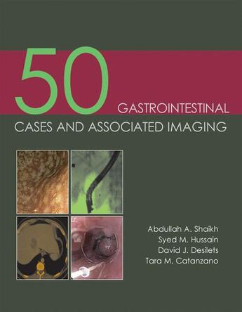 Couverture du livre « 50 Gastrointestinal Cases and Associated Imaging » de Abdullah Shaikh et Syed Hussain et David Desilets et Tara Catanzano aux éditions Tfm Publishing Ltd