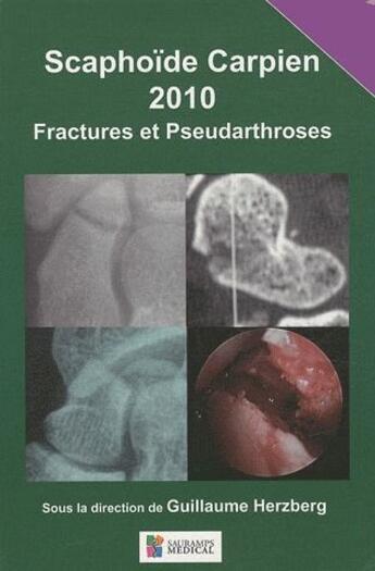 Couverture du livre « Scaphoïde carpien ; fractures et pseudoarthroses (édition 2010) » de Guillaume Herzberg aux éditions Sauramps Medical