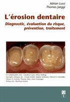 Couverture du livre « L'érosion dentaire : diagnostic, évaluation du risque, prévention, traitement » de  aux éditions Quintessence International