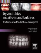 Couverture du livre « Dysmorphies maxillo-mandibulaires ; traitement orthodontico-chirurgical » de Pierre Canal et Patrick Goudot aux éditions Elsevier-masson