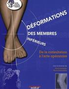 Couverture du livre « Déformations des membres inférieurs ; de la consultation à l'acte opératoire (édition 2009) » de Pierre Journeau et Pierre Lascombes aux éditions Sauramps Medical