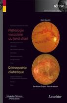 Couverture du livre « Pathologie vasculaire du fond d'oeil ; rétinopathie diabétique » de Alain Gaudric et Benedicte Dupas et Pascale Massin aux éditions Medecine Sciences Publications