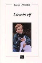 Couverture du livre « L'ecorche vif » de Lautier Franck aux éditions Societe Des Ecrivains