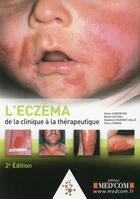 Couverture du livre « L eczema. de la clinique au traitement. 2 ed » de Carpentier & Co aux éditions Med'com