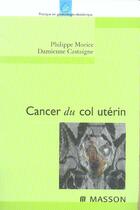 Couverture du livre « Cancer du col uterin » de Morice/Castaigne aux éditions Elsevier-masson