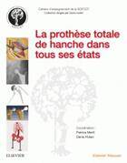 Couverture du livre « La prothèse totale de hanche dans tous ses états » de  aux éditions Elsevier-masson