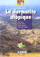 Couverture du livre « Dermatite Atopique » de Nicolas aux éditions John Libbey