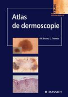 Couverture du livre « Atlas de dermoscopie » de Ralph P. Braun et Luc Thomas aux éditions Elsevier-masson