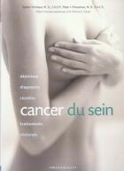 Couverture du livre « Cancer du sein » de Yashar Hirshaut et Peter Pressman aux éditions Marabout