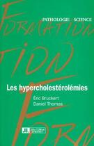 Couverture du livre « Les Hypercholesterolemies » de Bruckert aux éditions John Libbey