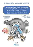 Couverture du livre « Radiologie post mortem : Manuel d'interprétation d'un scanner post mortem » de Kevin Mahe et Antoine Levasseur et Negre Pierrick aux éditions Eska