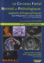 Couverture du livre « Le cerveau foetal normal et pathologique : aspects échographiques (2e édition) » de Bault Jean-Philippe et Laurence Loeuillet et Guillaume Benoist aux éditions Sauramps Medical