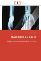 Couverture du livre « Hypoplasie du pouce - analyse retrospective d'une serie de 13 cas » de Gasnier Paul aux éditions Editions Universitaires Europeennes