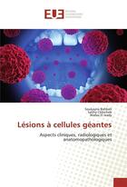 Couverture du livre « Lesions a cellules geantes » de Bahbah Soukayna aux éditions Editions Universitaires Europeennes