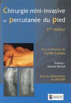 Couverture du livre « Chirurgie mini-invasive et percutanée du pied (2e édition) » de Cyrille Cazeau aux éditions Sauramps Medical