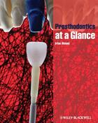 Couverture du livre « Prosthodontics at a Glance » de Irfan Ahmad aux éditions Wiley-blackwell