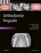 Couverture du livre « Orthodontie linguale » de Pierre Canal et Dirk Wiechmann aux éditions Elsevier-masson