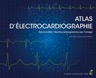 Couverture du livre « Atlas d'électrocardiographie : Reconnaître l'électrocardiogramme par l'image » de Jean-Claude Deharo et Ines Cibray aux éditions Pu De Provence