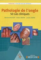 Couverture du livre « Pathologie de l'ongle ; 50 cas cliniques » de Richert et Baran aux éditions Med'com