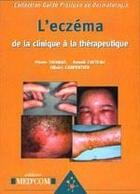 Couverture du livre « Guide pratique de la dermatologie ; l'eczéma : de la clinique à la thérapeutique » de Thomas/Catteau aux éditions Med'com