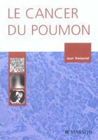 Couverture du livre « Le cancer du poumon » de Jean Tredaniel aux éditions Elsevier-masson