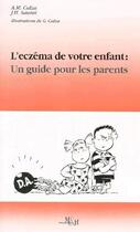 Couverture du livre « L'eczéma de votre enfant ; un guide pour les parents » de J-H Saurat et A-M Calza aux éditions Medecine Et Hygiene
