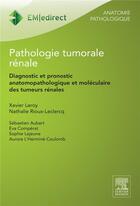 Couverture du livre « Pathologie tumorale rénale » de Xavier Leroy et Nathalie Roux-Leclercq aux éditions Elsevier-masson