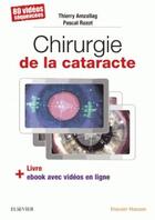 Couverture du livre « Chirurgie de la cataracte ; 80 vidéos séquencées » de Thierry Amzallag et Pascal Rozot aux éditions Elsevier-masson