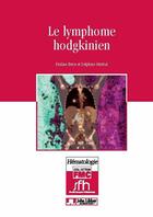 Couverture du livre « Le lymphome hodgkinien (2e édition) » de P Brice et Delphine Senecal aux éditions John Libbey