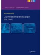 Couverture du livre « La sigmoïdectomie laparoscopique pour cancer » de Champault G. aux éditions Springer