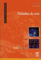 Couverture du livre « Maladies du sein (2e édition) » de Herve Mignotte aux éditions Elsevier-masson