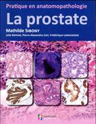 Couverture du livre « Pratique en anatomopathologie : la prostate » de Mathilde Sibony aux éditions Sauramps Medical