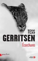 Couverture du livre « Écorchures » de Tess Gerritsen aux éditions Presses De La Cite
