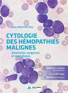 Couverture du livre « Cytologie des hémopathies malignes ; anomalies sanguines et médullaires » de Jean-Baptiste Rieu aux éditions John Libbey
