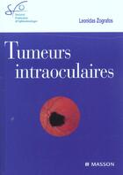 Couverture du livre « Tumeurs intraoculaires » de Leonidas Zografos aux éditions Elsevier-masson