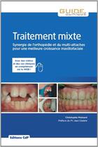 Couverture du livre « Traitement mixte ; synergie de l'orthopédie et du multi-attaches pour une meilleure croissance maxillo-faciale » de Christophe Moinard aux éditions Cahiers De Protheses