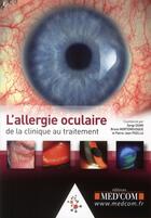 Couverture du livre « L'allergie oculaire : de la clinique au traitement » de Bruno Mortemousque et Pierre-Jean Pisella et Serge Doan aux éditions Med'com