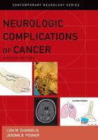 Couverture du livre « Neurologic Complications of Cancer » de Posner Jerome B aux éditions Oxford University Press Usa