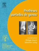 Couverture du livre « Prothèses partielles du genou » de Philippe Neyret aux éditions Elsevier-masson