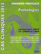 Couverture du livre « Cas clinique ; pathologies (édition 2013) » de Lionel Arrive et Tubiana Jean-Michel et Yves Menu aux éditions Sauramps Medical