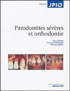 Couverture du livre « Parodontités sévères et orthodontie » de Marc Danan aux éditions Cahiers De Protheses